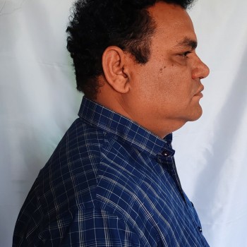 Right side Face